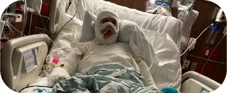 From Ashes to Advocacy: Pamelas Journey of Resilience A testament to the human spiri